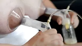 Момиче плешивост при ...